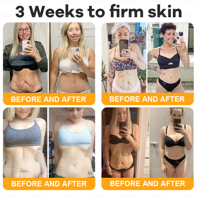 𝙈𝙖𝙙𝙚 𝙖𝙣𝙙 𝙎𝙝𝙞𝙥𝙥𝙚𝙙 𝙛𝙧𝙤𝙢 𝘾𝙖𝙣𝙖𝙙𝙖 🐝 𝗩𝗟𝗦𝗩𝗟𝗦® 𝑩𝒆𝒆 𝑽𝒆𝒏𝒐𝒎 𝑪𝒐𝒎𝒑𝒓𝒆𝒉𝒆𝒏𝒔𝒊𝒗𝒆 𝑪𝒓𝒆𝒂𝒎