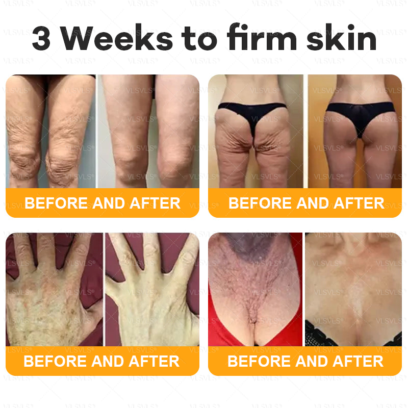 𝙈𝙖𝙙𝙚 𝙖𝙣𝙙 𝙎𝙝𝙞𝙥𝙥𝙚𝙙 𝙛𝙧𝙤𝙢 𝘾𝙖𝙣𝙖𝙙𝙖 🐝 𝗩𝗟𝗦𝗩𝗟𝗦® 𝑩𝒆𝒆 𝑽𝒆𝒏𝒐𝒎 𝑪𝒐𝒎𝒑𝒓𝒆𝒉𝒆𝒏𝒔𝒊𝒗𝒆 𝑪𝒓𝒆𝒂𝒎