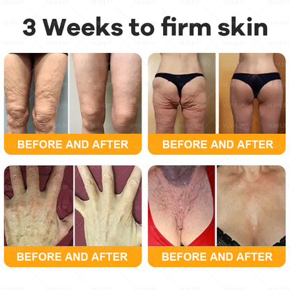 𝙈𝙖𝙙𝙚 𝙖𝙣𝙙 𝙎𝙝𝙞𝙥𝙥𝙚𝙙 𝙛𝙧𝙤𝙢 𝘾𝙖𝙣𝙖𝙙𝙖 🐝 𝗩𝗟𝗦𝗩𝗟𝗦® 𝑩𝒆𝒆 𝑽𝒆𝒏𝒐𝒎 𝑪𝒐𝒎𝒑𝒓𝒆𝒉𝒆𝒏𝒔𝒊𝒗𝒆 𝑪𝒓𝒆𝒂𝒎