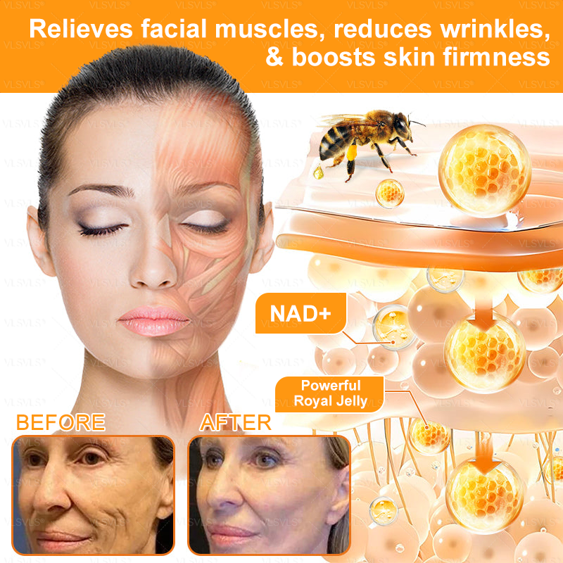 𝙈𝙖𝙙𝙚 𝙖𝙣𝙙 𝙎𝙝𝙞𝙥𝙥𝙚𝙙 𝙛𝙧𝙤𝙢 𝘾𝙖𝙣𝙖𝙙𝙖 🐝 𝗩𝗟𝗦𝗩𝗟𝗦® 𝑩𝒆𝒆 𝑽𝒆𝒏𝒐𝒎 𝑪𝒐𝒎𝒑𝒓𝒆𝒉𝒆𝒏𝒔𝒊𝒗𝒆 𝑪𝒓𝒆𝒂𝒎